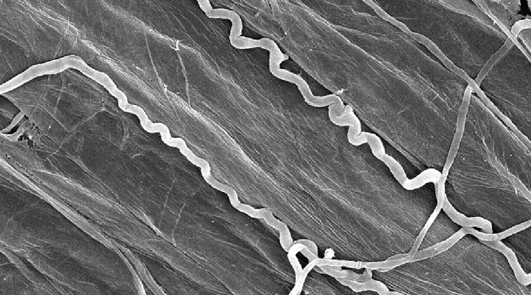 Closeup look at endophyte fungus growing in between fescue plant cells